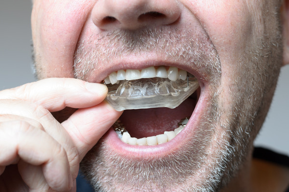 man with occlusal splint 